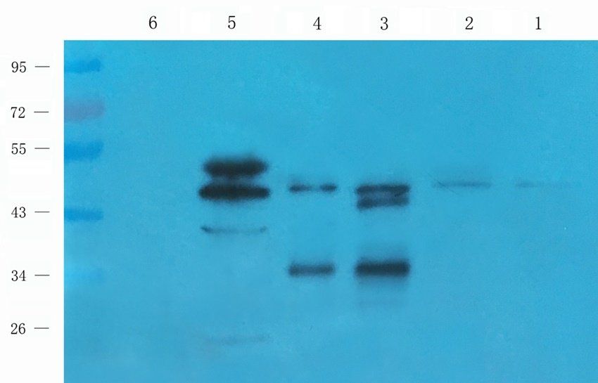 RCAN1 antibody