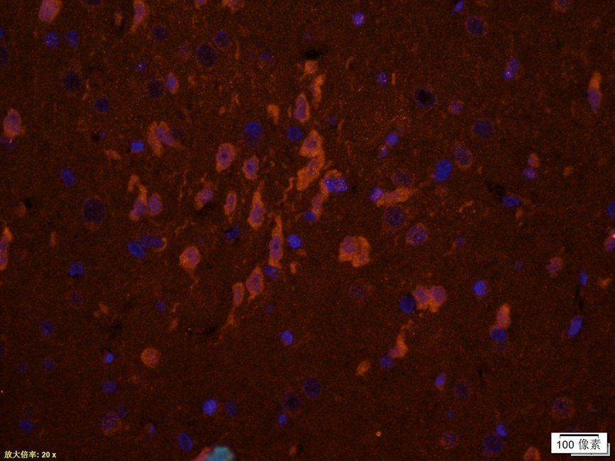 RCAN1 antibody