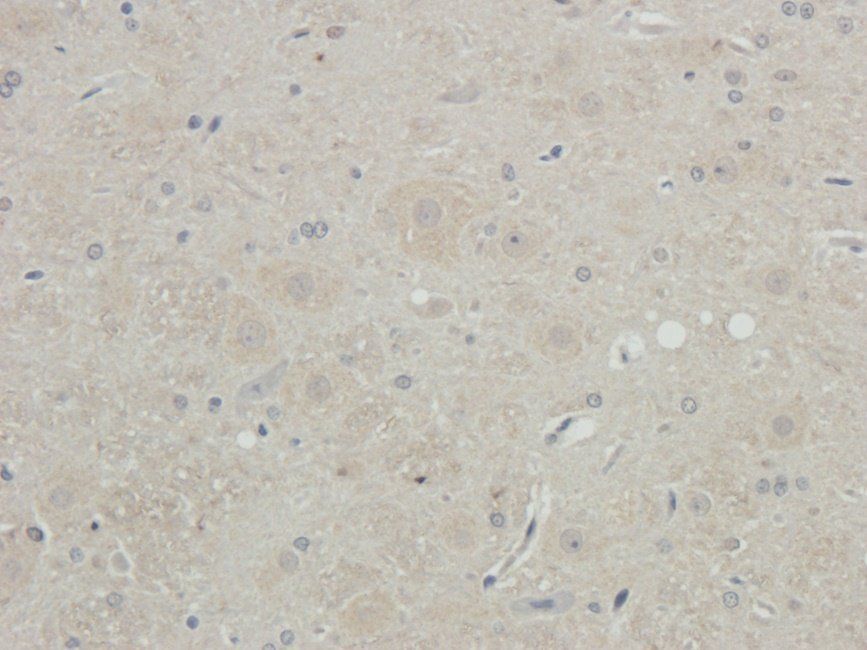 RCAN1 antibody