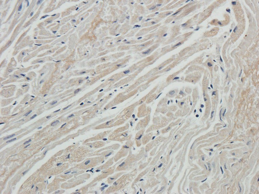 RCAN1 antibody