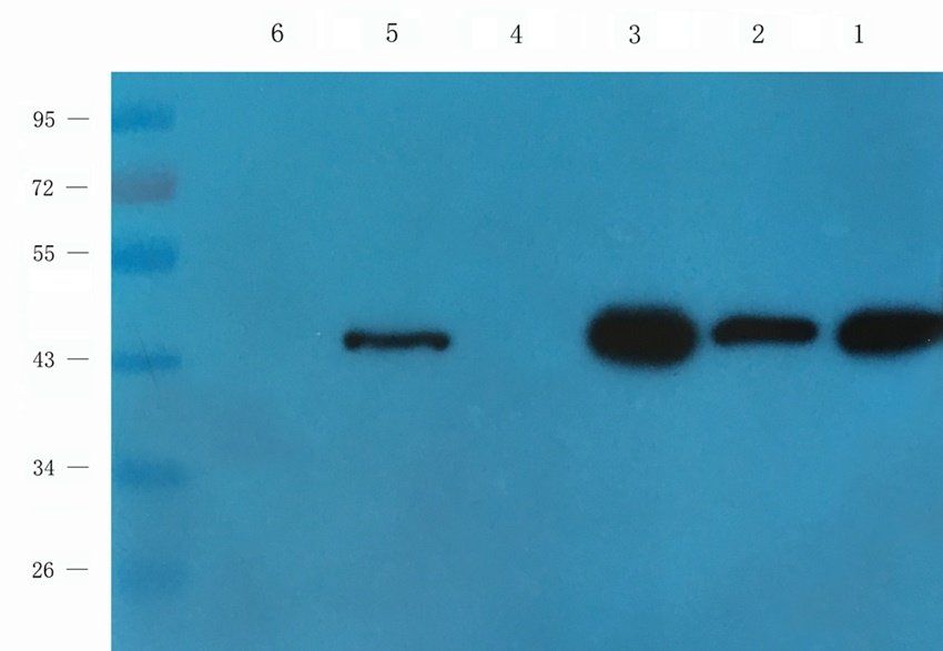 RCAN1 antibody