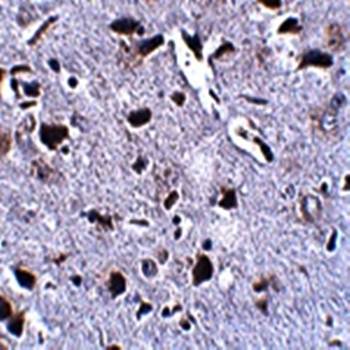 RCAN2 Antibody