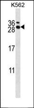RCAN3 antibody