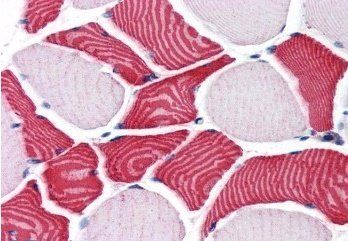 Goat anti-EBAG9 / RCAS1 Antibody