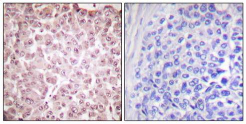 RCBTB1 Antibody