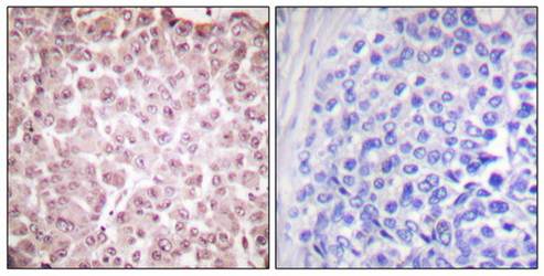 RCBTB1 antibody