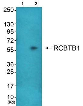 RCBTB1 antibody