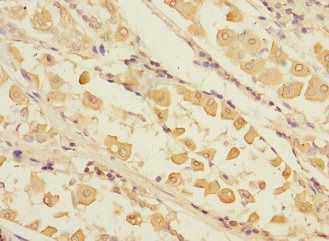RCHY1 Antibody