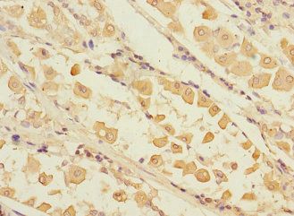 RCHY1 antibody