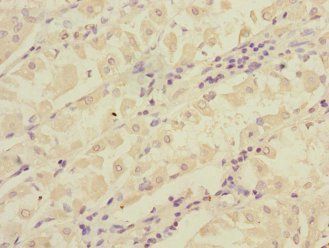 RCHY1 antibody