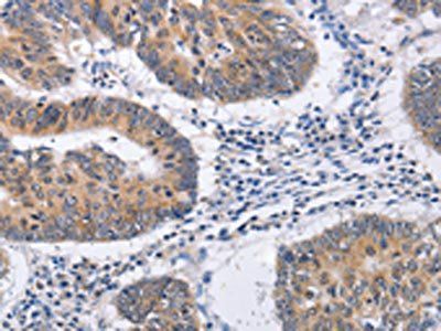 RCHY1 Antibody