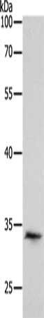 RCHY1 antibody