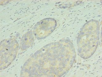 RDH12 Antibody