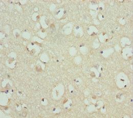 RDH12 Antibody