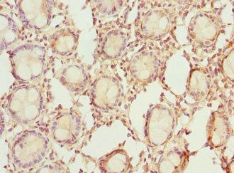 RDH5 Antibody