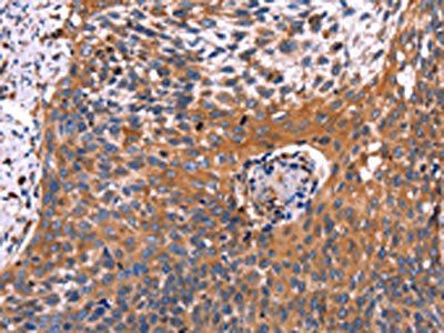 RDX Antibody