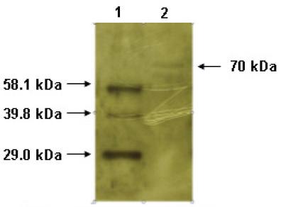 Mouse anti Human Tyrosine Kinase Antibody