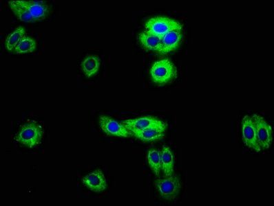 RECK antibody