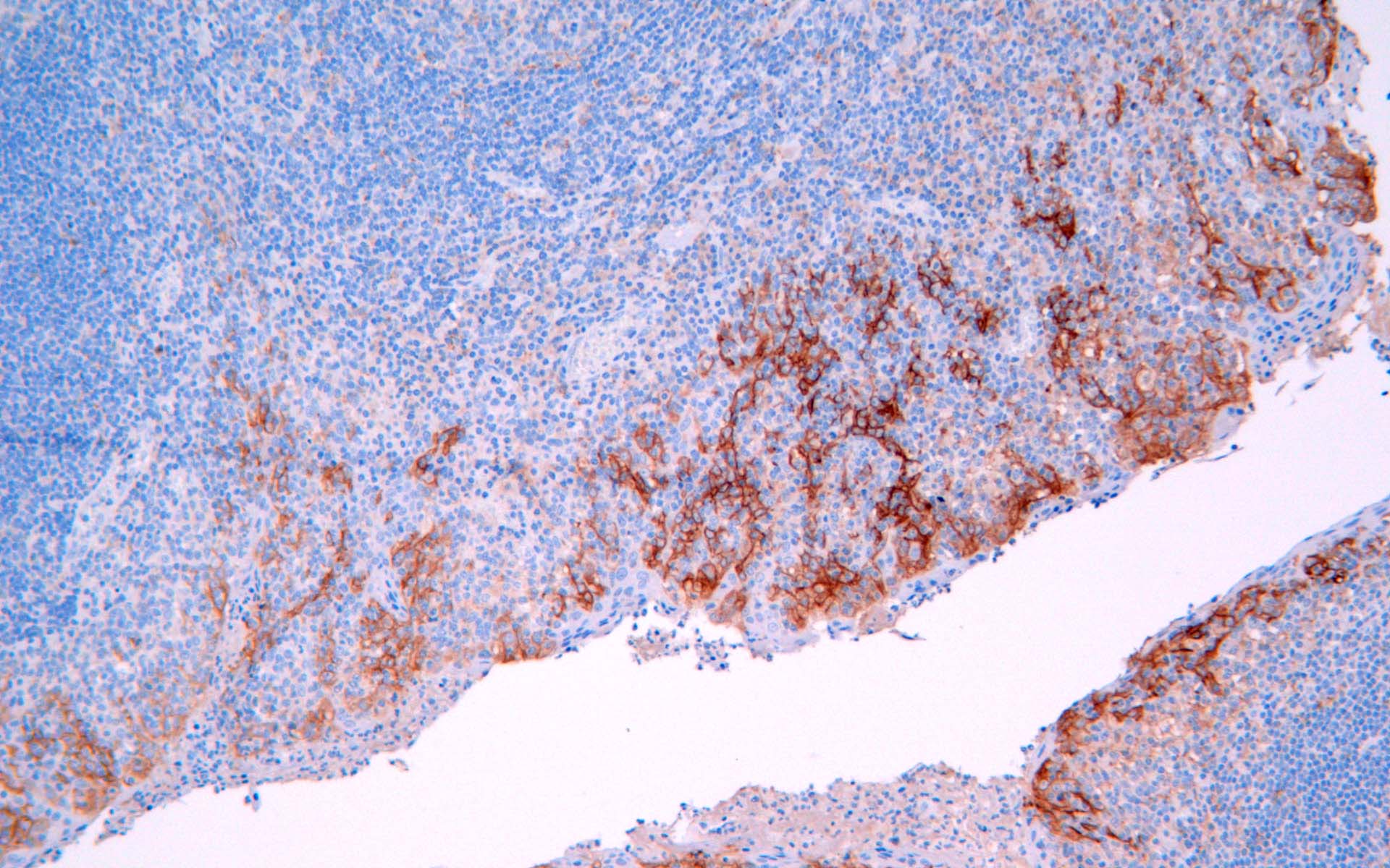 Recombinant PD-L1 antibody