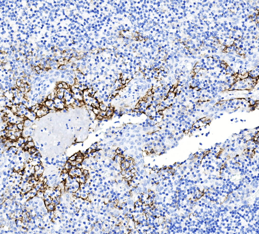 Recombinant PD-L1 antibody