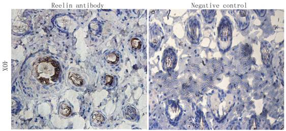 Reelin antibody