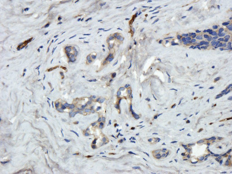 Reelin antibody