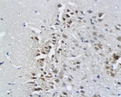 Reelin antibody