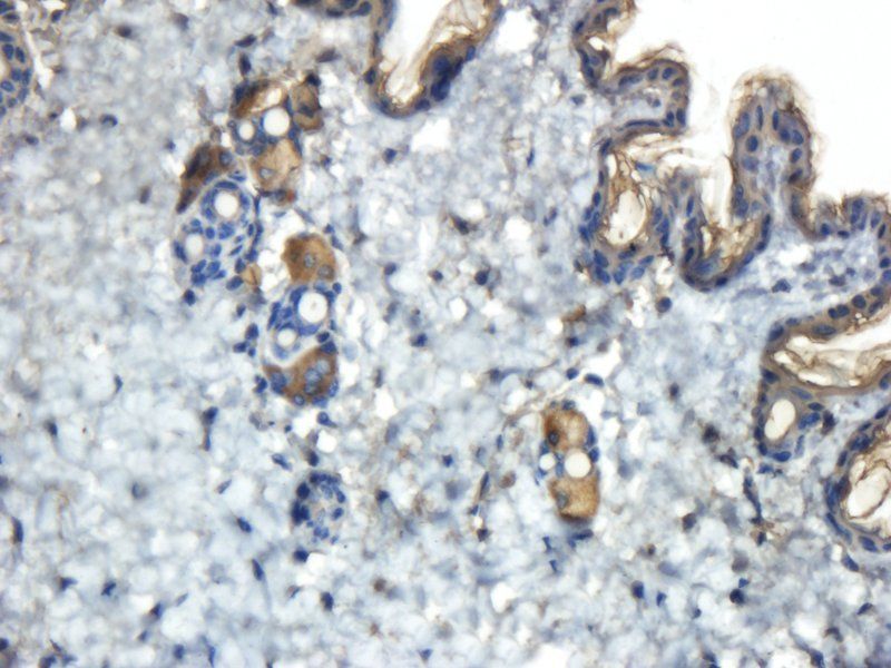 Reelin antibody