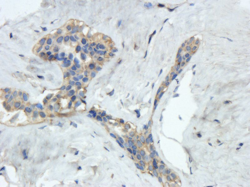 Reelin antibody