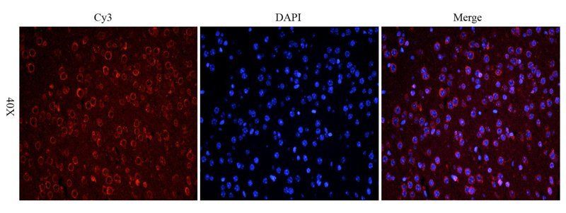 Reelin antibody