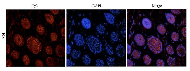 Reelin antibody