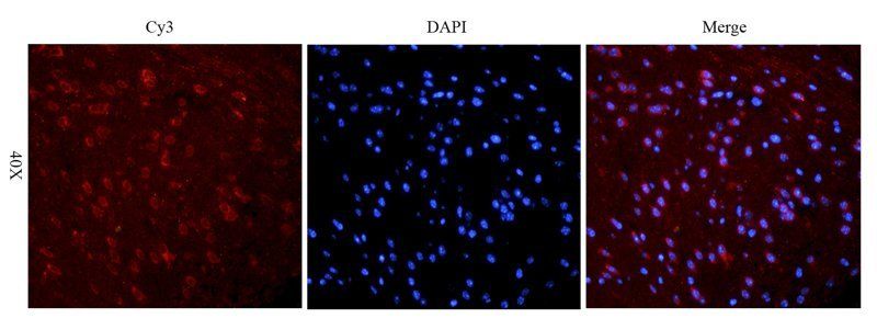 Reelin antibody