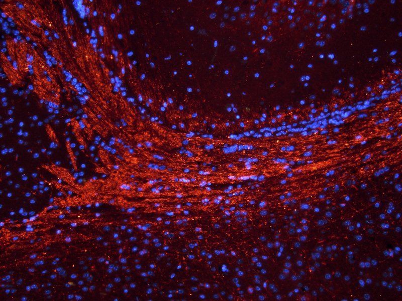 Reelin antibody