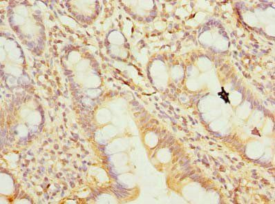REEP4 Antibody