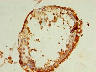 REEP4 Antibody