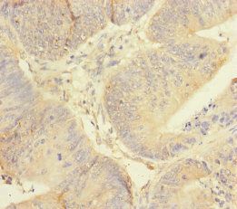 REEP5 Antibody