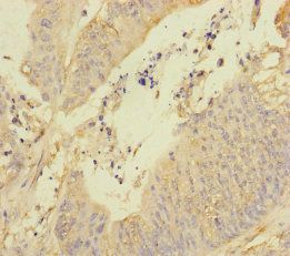 REEP5 Antibody