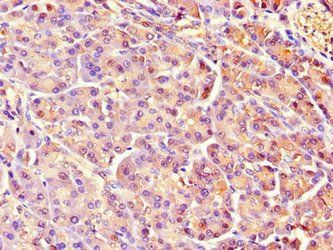 REG1A Antibody