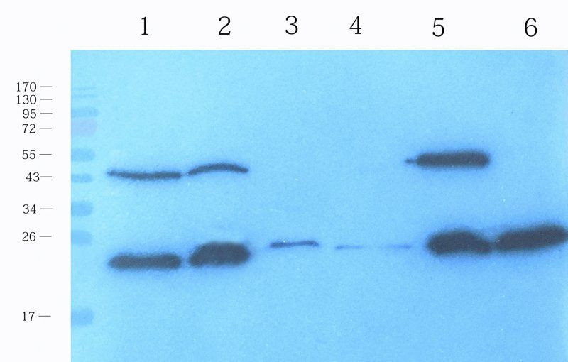 Reg3 gamma antibody