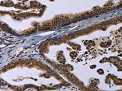 REG3A Antibody