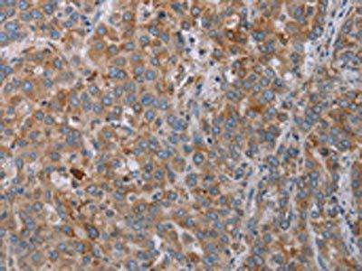 REG3A Antibody