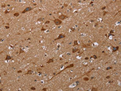 REG3A Antibody