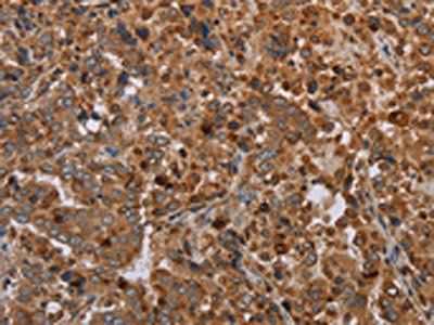 REG3A Antibody