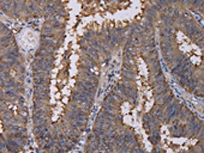 REG3G Antibody