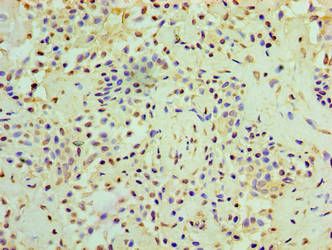 RMDN3 Antibody