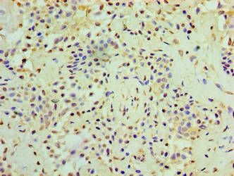 Regulator of microtubule dynamics protein 3 antibody