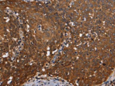 REL Antibody