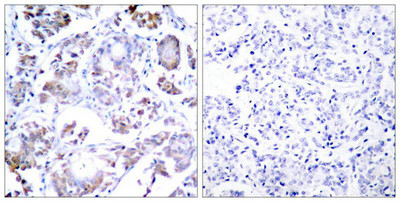 RELA Antibody