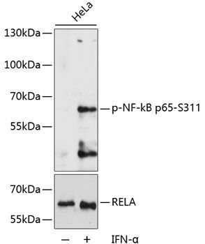RELA (Phospho-S311) antibody