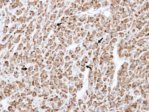 RELT antibody